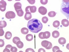 Which type of leukocyte is shown here?
a) Monocyte
b) Basophil
c) Eosinophil
d) Segmented Neutrophil
e) Band Neutrophil