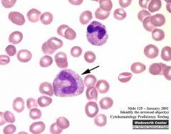 Which type of leukocyte is shown here?
a) Monocyte
b) Basophil
c) Eosinophil
d) Segmented Neutrophil
e) Band Neutrophil