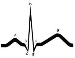 Label and Define Each part of the ECG Wave