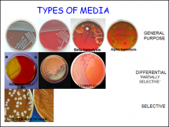 What are the different advantages for the GENERAL PURPOSE media, DIFFERENTIAL/"Partially selective" media and SELECTIVE media types?