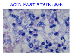 When you are doing an ACID FAST STAIN, what do the MYCOBACTERIA look like?
