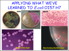 What is the difference between MacConkey agar and MacConkey-sorbital agar? Which type of e. coli (commensal or pathogenic) can ferment sorbitol? 

What color would it appear as on a gram stain? What shape is e.coli?