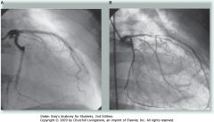 Coronary angiography-small arterial catheters are maneuvered from a FEMORAL ARTERY puncture site through the femoral artery and AORTA and up to the origins of the CORONARY VESSELS. X-ray contrast medium is then injected to demonstrate the coronary vessels