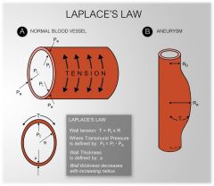 LaPlace's Law.

Aneurysms!!!