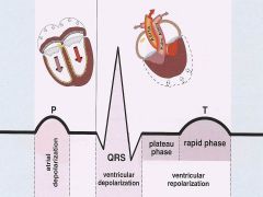 Why is the both the QRS phase (ventricular depolarization) an the T phase (ventricular repolarization) both on the positive side of the EKG? How is that possible?