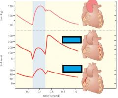 VERY IMPORTANT* why is the left side of the heart so much more affected by intramyocardial pressure than the right side of the heart?  Which coronary artery (left or right) has highest blood flow during systole? Diastole? When does this change and why?