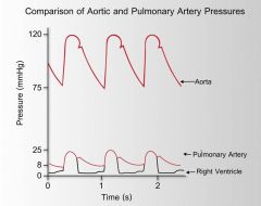 Pulsatility is lower in the aorta than in the pulmonary trunk/ arteries

The waveforms between the aorta and the pulmonary artery for the cardiac cycle diagram are
very similar but the pulmonary artery and right ventricle function at 1/6 less pressure.