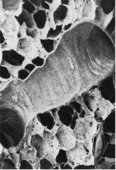 Section of lung showing many alveoli and a small brochiole. The pulmonary capillaries run in the walls of the alveoli. The holes in the alveolar walls are the pores of Kohn