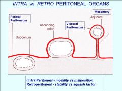 (Intra)Peritoneal - mobility vs malposition
Retroperitoneal - stability vs squash factor