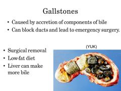 Why is it not a problem for us to remove the gall bladder in an emergency?