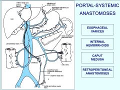 Match the portal/ systemic anastomosis with the veins? Which one is the most fatal?