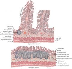 How can you tell the difference among the duodenum, jejunum, and illium histologically?

What is something only found in illium? What about duodenum?