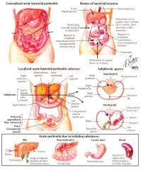 PARIETAL PERITONIUM


Referred pain from various visceral structures is
common until the disease involves the parietal peritoneum or somatically innervated body wall.
Localized pain because the nerves serving the abdominal wall recieve general somati
