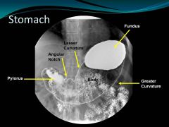 Main Points:
1. Angular notch separates pyloris from body
2. Explain that this is double contrast.  Mention why contrast is at the fundus and pyloris (because those areas are dependant – pt supine)