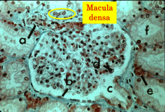 Renal corpuscle showing vascular pole (a), urinary pole (c ), parietal epithelium (b), visceral epithelium (d), peritubular capillaries (e), and proximal tubules (f). Can you identify a macula densa?


Vascular pole up
Urinary pole down
b= parietal e