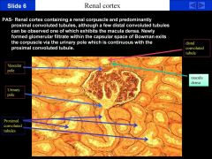 S1-S3 all have microvillus brush border.
macula densa
parietal epithelial
proximal tubules -contain debris in lumen
urinary pole

A periodic acid shift stain of the renal cortex containing a renal corpuscle. This basically
shows the carbohydrate-ri