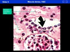 to left= proximal tubles
bottom= renal corpuscule

A close up H&E stain of the macula densa. It means dark spot and it stains darkly because of the nuclei. It is adjacent to the glomerulus.