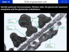 TEM of the filtration membrane or glomerular wall across which, filtration occurs. The lumen of the urinary space is on the top and the lumen of the capillary space is on the bottom. The top blobs are the foot processes with the plasma membrane surroundin