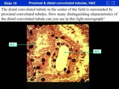 proximal convoluted tubule slide