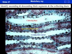 Know this slide! Dr. Andrews said not so subtly that it will be tested!! This slide shows a
medullary ray. It has 3 parts – the ascending thick, the descending thick, and collecting duct. The
medullary ray is found in the cortex with the superficial nep