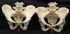 How can you tell the difference between a male and a female pelvis?