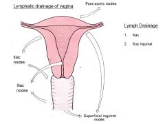 Where does all the lymph drainage for the lady part go to?