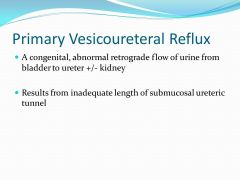 Bilateral Ureteral Reflux

L incomplete duplication
R complete duplication
Drooping lily sign