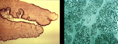 Which one is the mammary gland, and which one is the labia? How can you tell which is which?