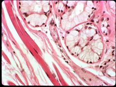 The skeletal muscle here is CLASSIC of which gland here?