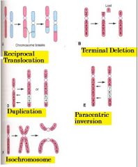 A. RECIPROCAL TRANSLOCATION
B. TERMINAL DELETION
D. TERMINAL DELETION
E. PARACENTRIC INVERSION
F. ISOCHROMOSOME