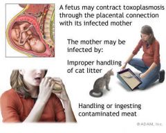 INFECTIOUS  AGENTS  AS  TERATOGENS: What is the only anti-body able to cross the placenta? What are some terotogenic infectious agents?