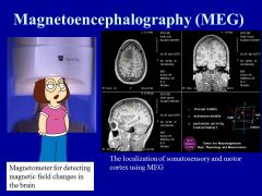 What are the pros/ cons of using MAGNETOENCEPHALOGRAPHY (MEG) for figuring out cortical functions?