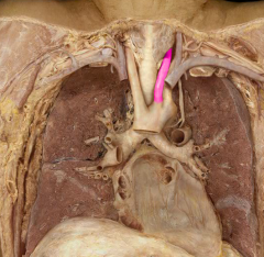 Left common carotid artery