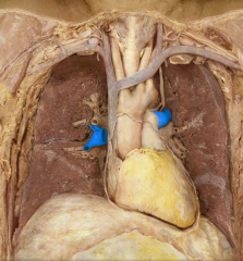 Pulmonary arteries