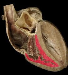 Myocardium of right ventricle