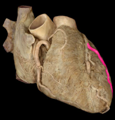 Left marginal (obtuse) artery