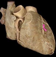 Left anterior ventricular artery