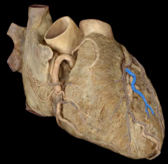 Left anterior ventricular vein