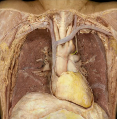 Left recurrent laryngeal nerve