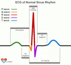 -Atrial depolarization
-ECG wave that occurs toward the end of the entire heart's diastolic period and beginning of atrial systole