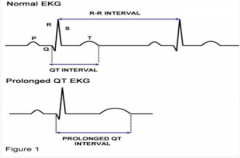 Use rule of thumb that normal QT is less than half the RR interval
