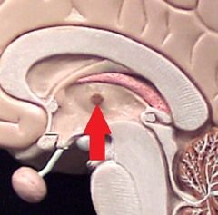 Yellow button in middle of thalamus