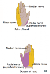 Median nerve (C5-T1) = proximal lesion
- "Ape hand" and "Pope's blessing"
- Loss of wrist and lateral finger flexion, thumb opposition, lumbricals of 2nd and 3rd digits
- Loss of sensation over thenar eminence and dorsal and palmer aspects of l...
