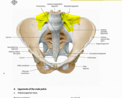 It is the strong set of ligaments that attaches L4, L5 to the iliac bone.

It is clinically relevant because there are a lot of pain receptors here that are responsible for back pain in the case that they are sprained