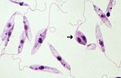 Which of the following pathogens is visible here?
a) Babesia Canis Canis
b) Anaplasma Phagocytophilum
c) Leishmania
d) Bartonella Henselae
e) Borrelia
f) Ehrilichia Canis