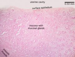 Uterus:
 
● Uterine cavity 
● Surface epithelium
● Mucosa with mucous and uterine glands