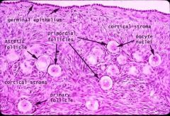Ovary:
 
● Cortical stroma
● Primordial follicles
● Ovarian follicles