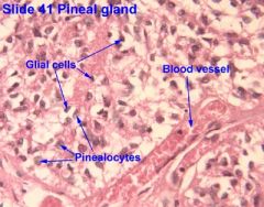 Pineal gland:
 
● Glial cells
● Pinealocytes