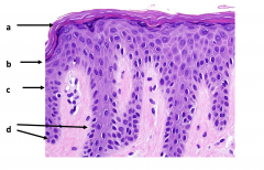 4 major layers of epidermis
