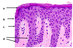 What are the the four major layers of the epidermis?